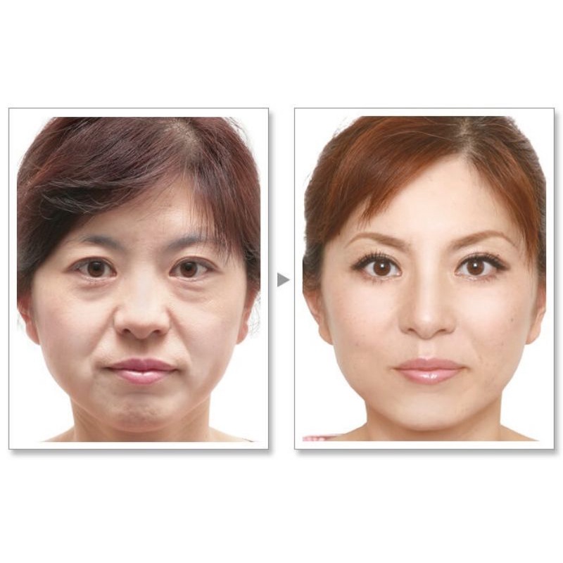 Máy nâng cơ Dr. Arrivo The Zeus S