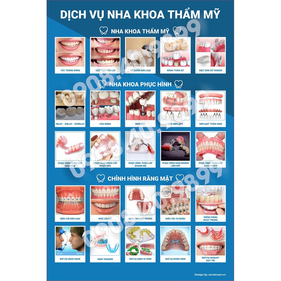 Tranh nha khoa các chủ đề: dịch vụ, giải phẫu, răng sứ, implant, chỉnh nha, phản vệ... chất liệu IN ẢNH CÁN BÓNG