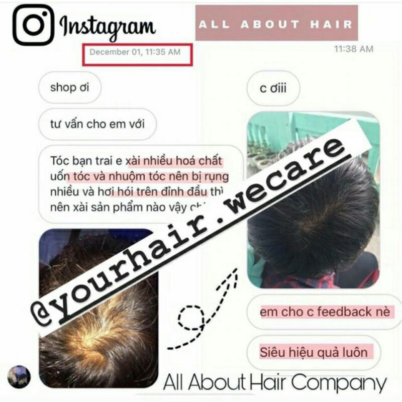 Ủ Kích Mọc Tóc oil treatment tặng kèm hủ hair repair | 🎁 Tặng mũ trùm ủ tóc | BigBuy360 - bigbuy360.vn