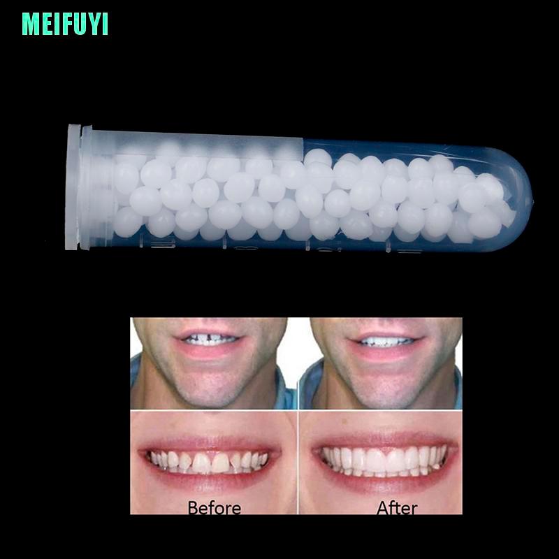 (Hàng Mới Về) Bộ 1 Tuýp Keo Dán Răng Giả 10g Chất Lượng Cao