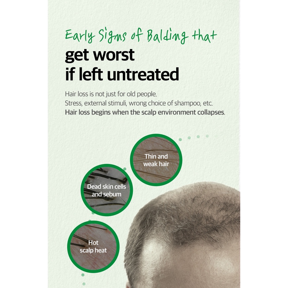 Combo 2 Sản Phẩm Ngăn Rụng Tóc Some By Mi Cica Peptide Anti-Hair Loss Derma Scalp(Dầu gội285ml+Xịt dưỡng150ml)