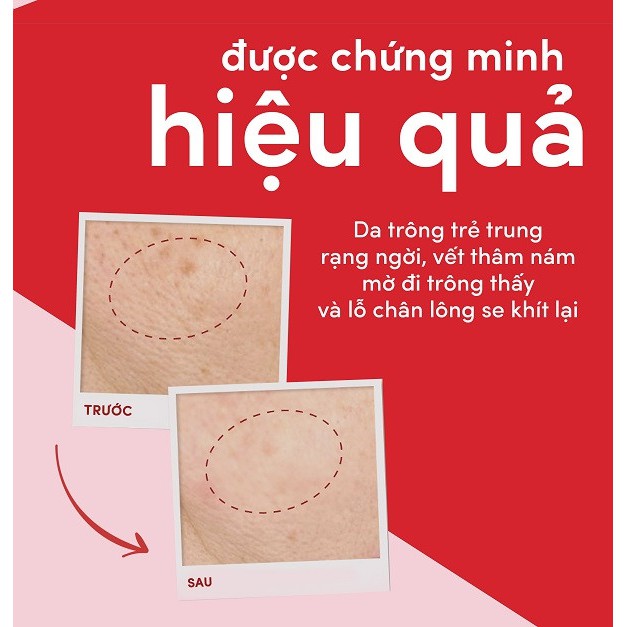 Combo dưỡng chất và kem dưỡng ẩm ngày, đêm Pond's ngăn ngừa lõa hóa