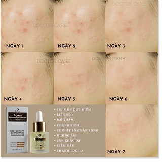 Serum Tri mun BỌC Doctor Care