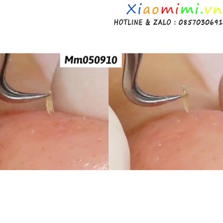 Nhíp gắp mụn đa năng Thần Thánh [Hàn Quốc]
