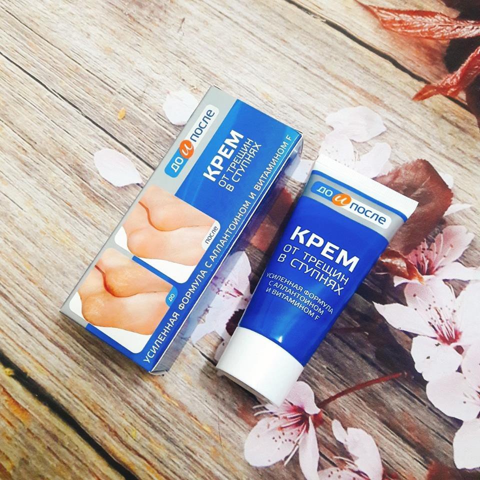 Kem Giảm Và Phục Hồi Nứt Nẻ Gót Chân Kpem 50ml