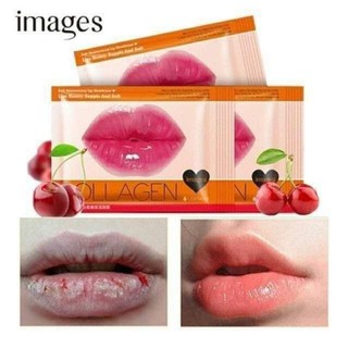 Mặt Nạ Môi Cherry Collagen Giảm Thâm, Hồng Môi