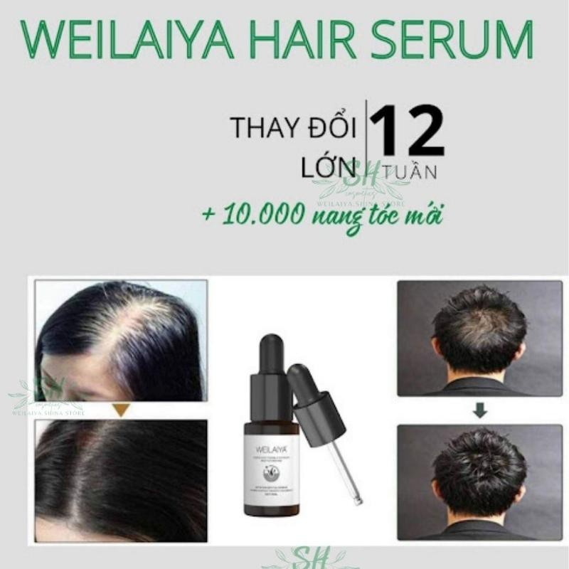 Huyết Thanh Serum Weilaiya Hỗ Trợ Mọc Tóc Hiệu Quả Sau 12 Tuần Sử Dụng [Hộp 8 Lọ]. Hàng Chính Hãng Sẵn SLL