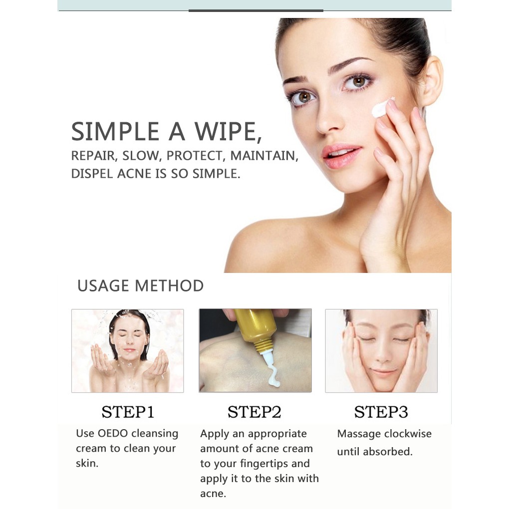 Kem Hỗ Trợ Giảm Mụn OEDO Kiềm Dầu Thu Nhỏ Lỗ Chân Lông Ngăn Ngừa Mụn 20g | BigBuy360 - bigbuy360.vn