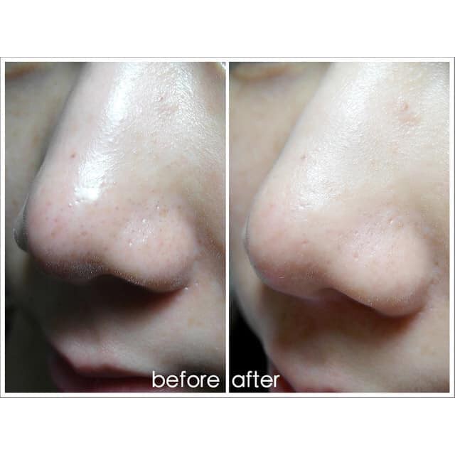 DR.WU Serum Tái Tạo Da Mandelic Acid 8% và 18%