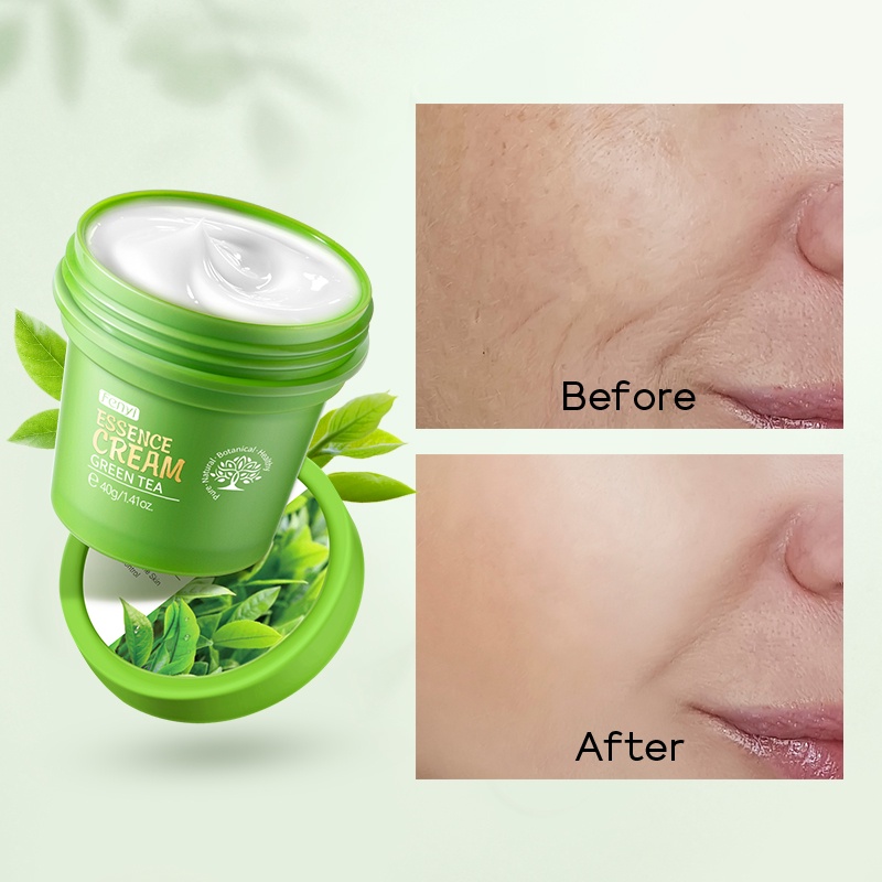 Kem dưỡng FENYI chiết xuất trà xanh nuôi dưỡng sâu giảm mụn làm mịn da hiệu quả 40g