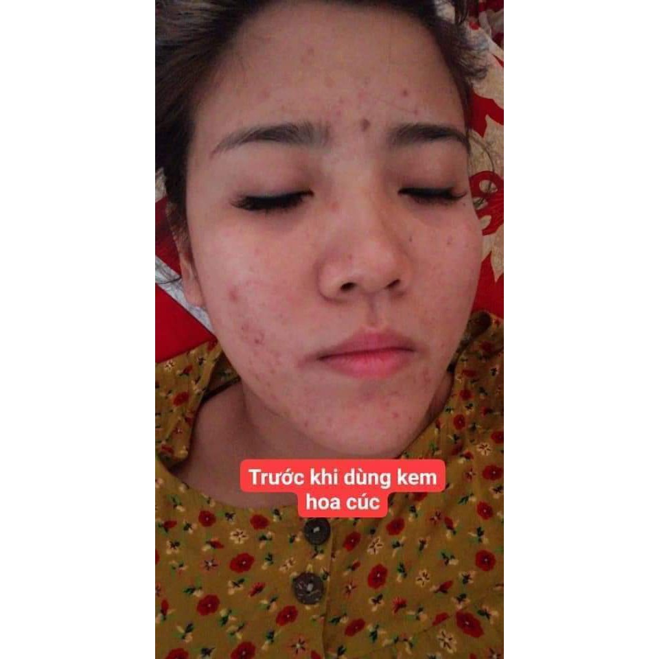 Kem hoa cúc pau jen pai(1 ngày 1 đêm) | BigBuy360 - bigbuy360.vn