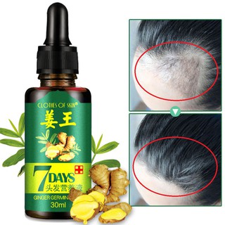 Tinh Chất Gừng Kích Thích Mọc Tóc Cho Nam Và Nữ