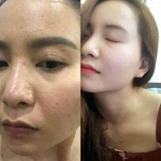 Combo serum collagen, kem face BN White