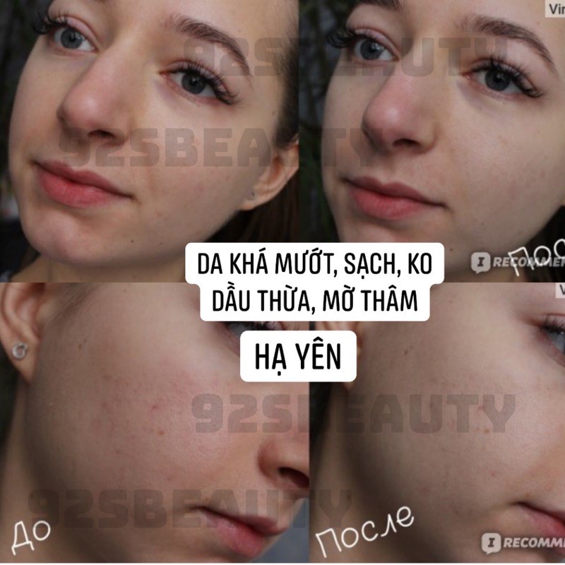 Toner nước hoa hồng Teatree Botanic Expert làm sạch sâu, ngừa mụn, mờ thâm | BigBuy360 - bigbuy360.vn