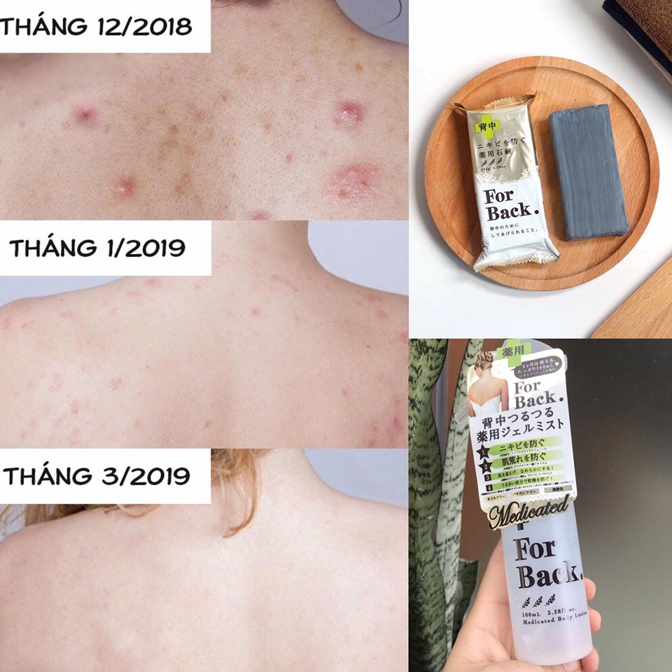 Xịt mụn lưng For Back Nhật Bản giảm mụn lưng, mờ thâm, lưng trắng mịn