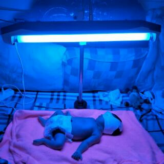 Đèn chiếu vàng da cho trẻ sơ sinh được bộ Y tế chứng nhận Chân đứng 1,6m thumbnail
