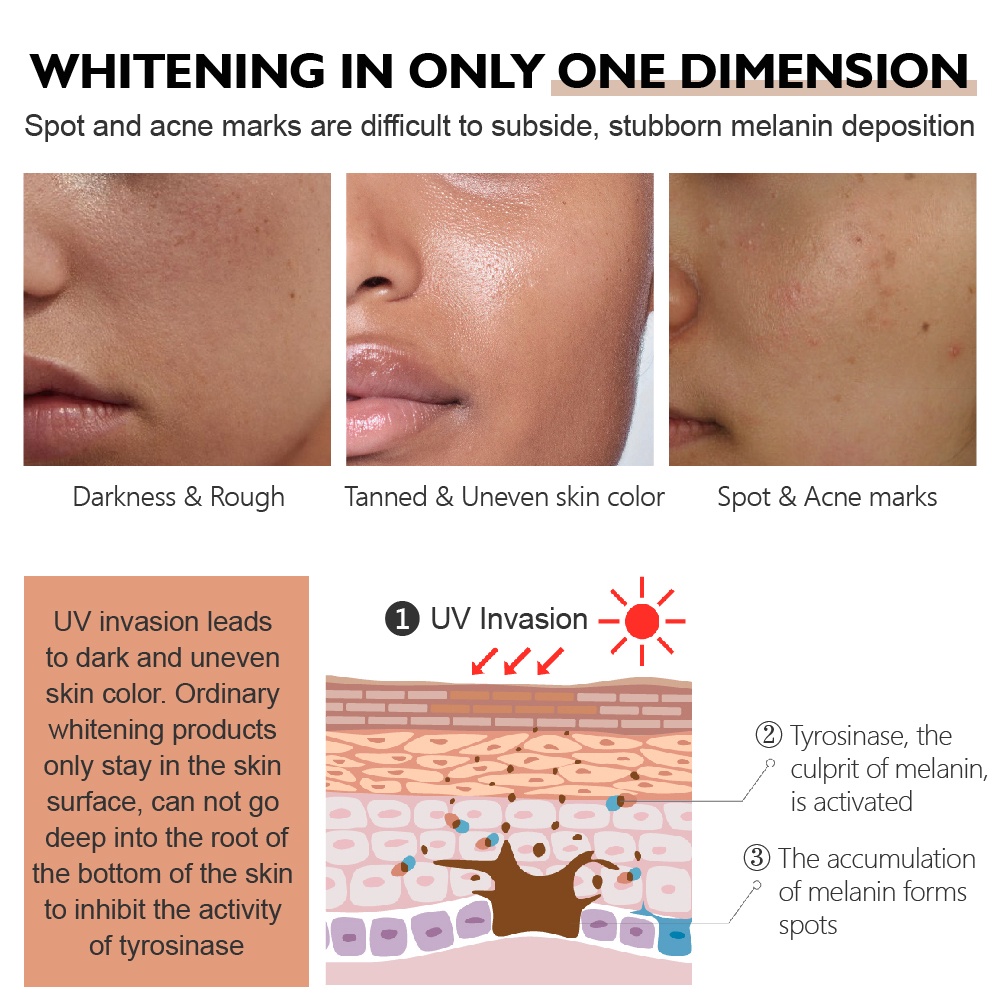 Tinh Chất Dưỡng Ẩm Làm Trắng Da Giảm Sắc Tố Tối Màu Tàn Nhang Hiệu Quả | BigBuy360 - bigbuy360.vn