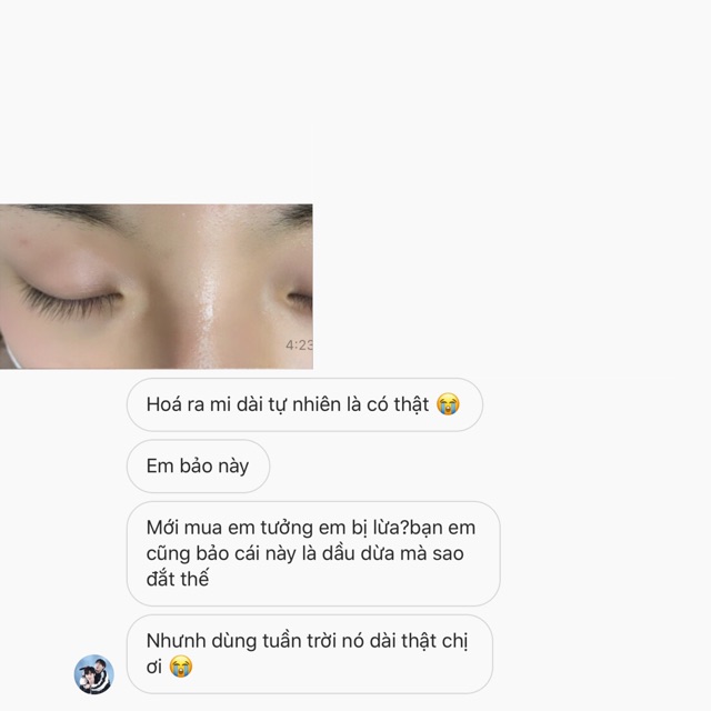 Dưỡng mi dài và dày siêu kích mọc 12ml (xem feedback thật) | BigBuy360 - bigbuy360.vn