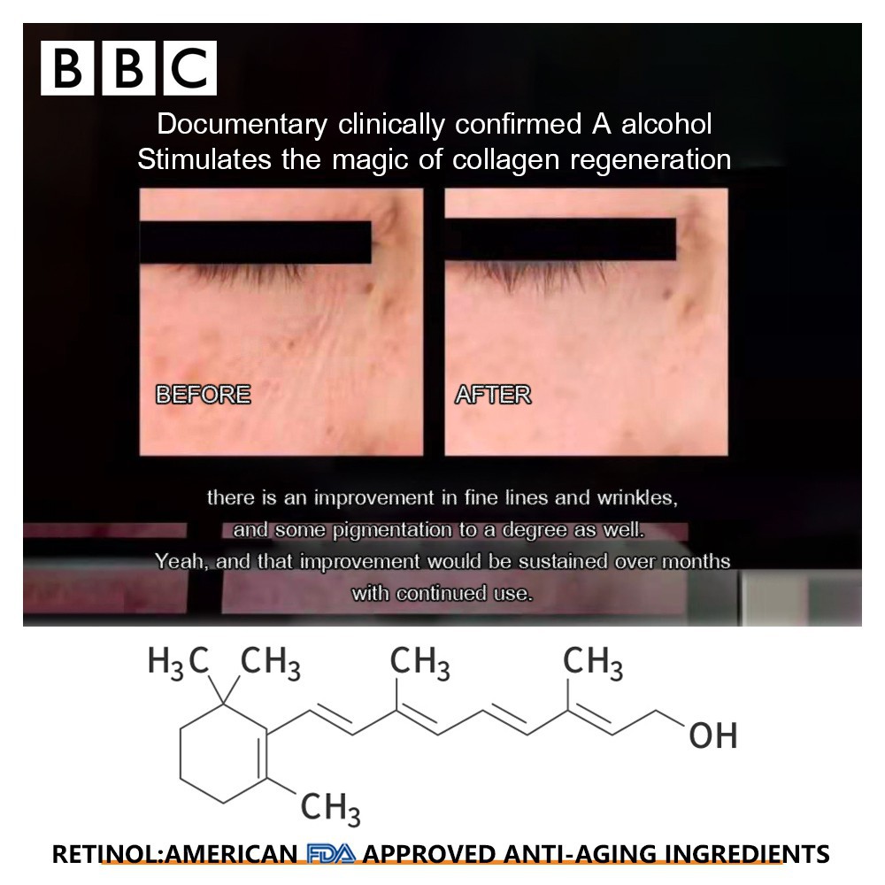 Kem Dưỡng Da Mặt VIBRANT GLAMOUR Chiết Xuất Retinol Tự Nhiên 2.5% Và Axit Hyaluronic Giữ Ẩm Chống Lão Hóa 30g | BigBuy360 - bigbuy360.vn