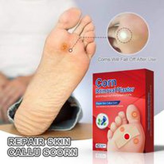 1 hộp 42 miếng dán ngăn mụn cóc dưới chân hiệu quả