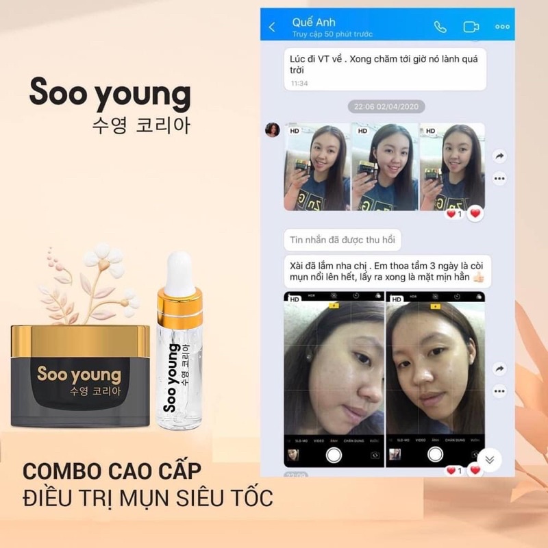 Bộ Kem Face Serum Mụn Soo Young