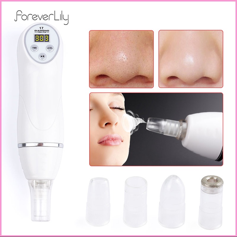 Foreverlily Cổ Phiếu Sẵn Sàng | Máy Hút Mụn Đầu Đen Cầm Tay Tiện Lợi