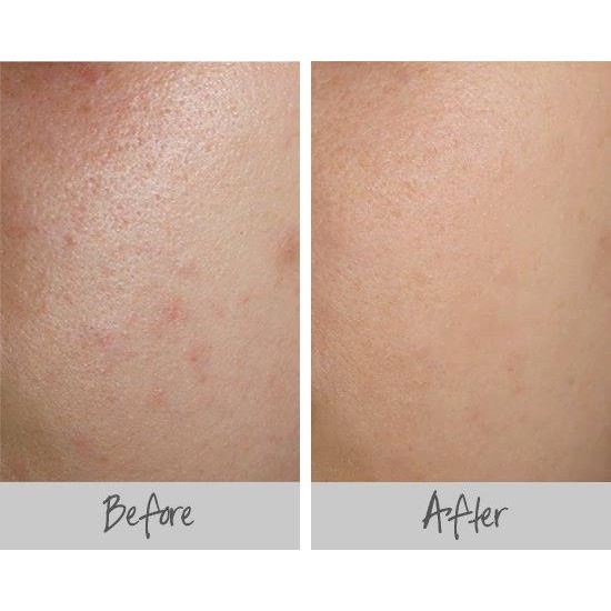 Kem lót New York Baby Skin Instant Pore Eraser Primer (Made in Usa) 20ml | BigBuy360 - bigbuy360.vn