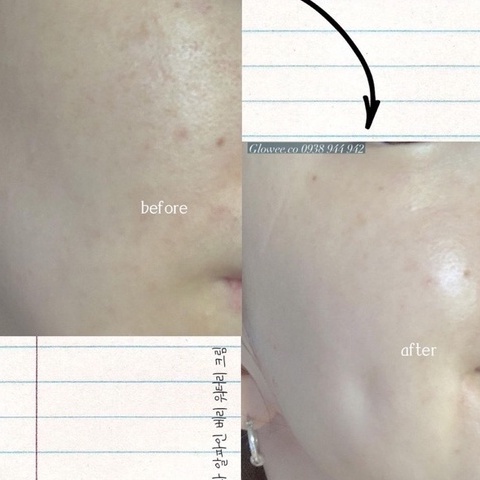 Kem dưỡng phục hồi PRIMERA