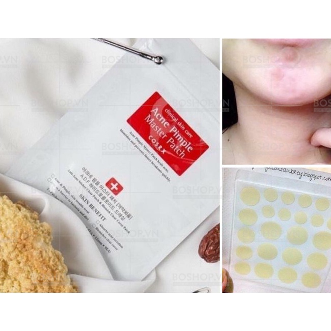 Miếng Dán Mụn COSRX Acne Pimple - Clear Fit Master Patch - COSRX