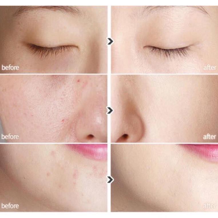 🇰🇷 KEM NỀN TRANG ĐIỂM BB Cream 4U Special Solution ASPASIA