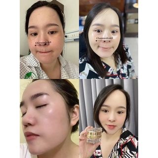 Kem tái tạo chamomileskill Mẫu Mới