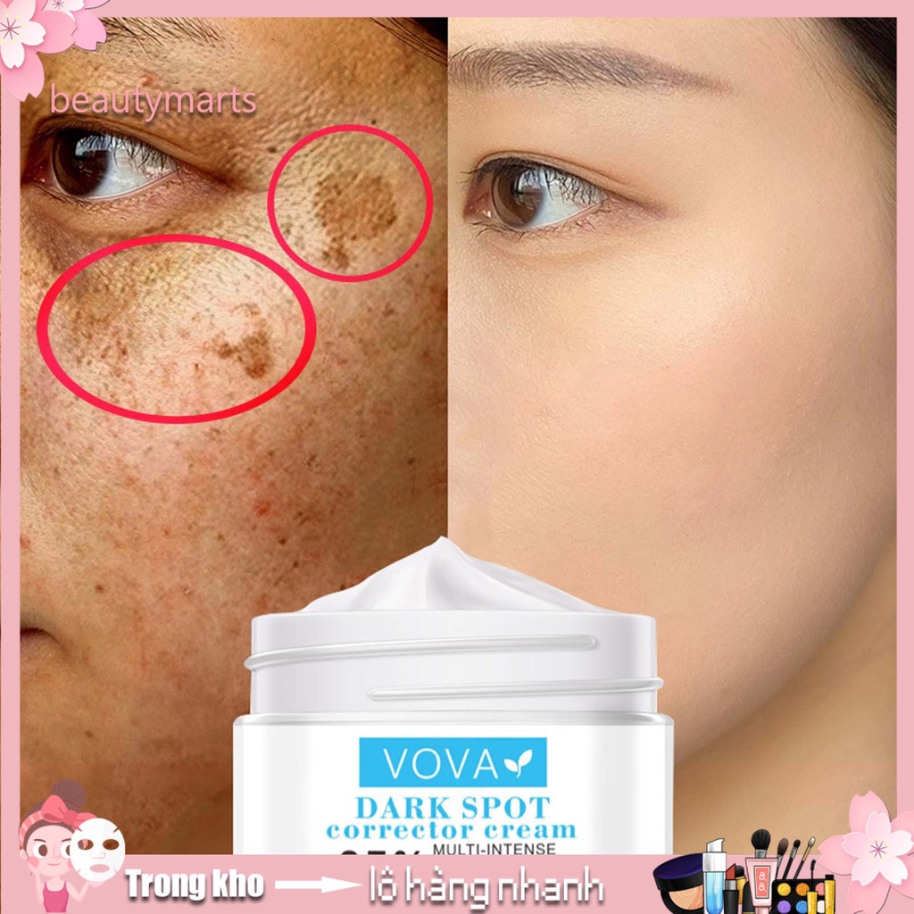 Kem Loại Bỏ Sắc Tố Melanin 30Ml Chiết Xuất Tự Nhiên Cao Cấp