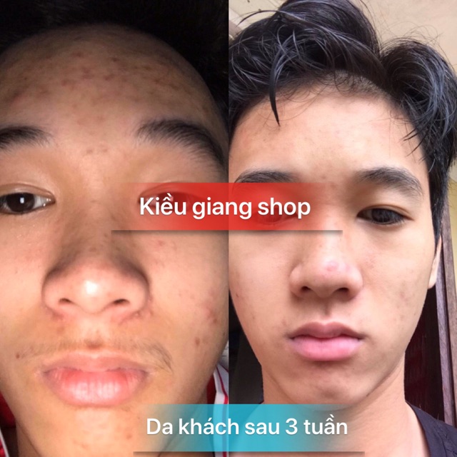 Serum đường đen Black sugar(khẳng định hiệu quả hơn mẫu caramel hồng nhé) KHÔNG HIỆU QUẢ HOÀN TIỀN | BigBuy360 - bigbuy360.vn