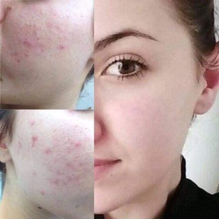 Nước Tẩy Trang Byphasse Solution Micellaire