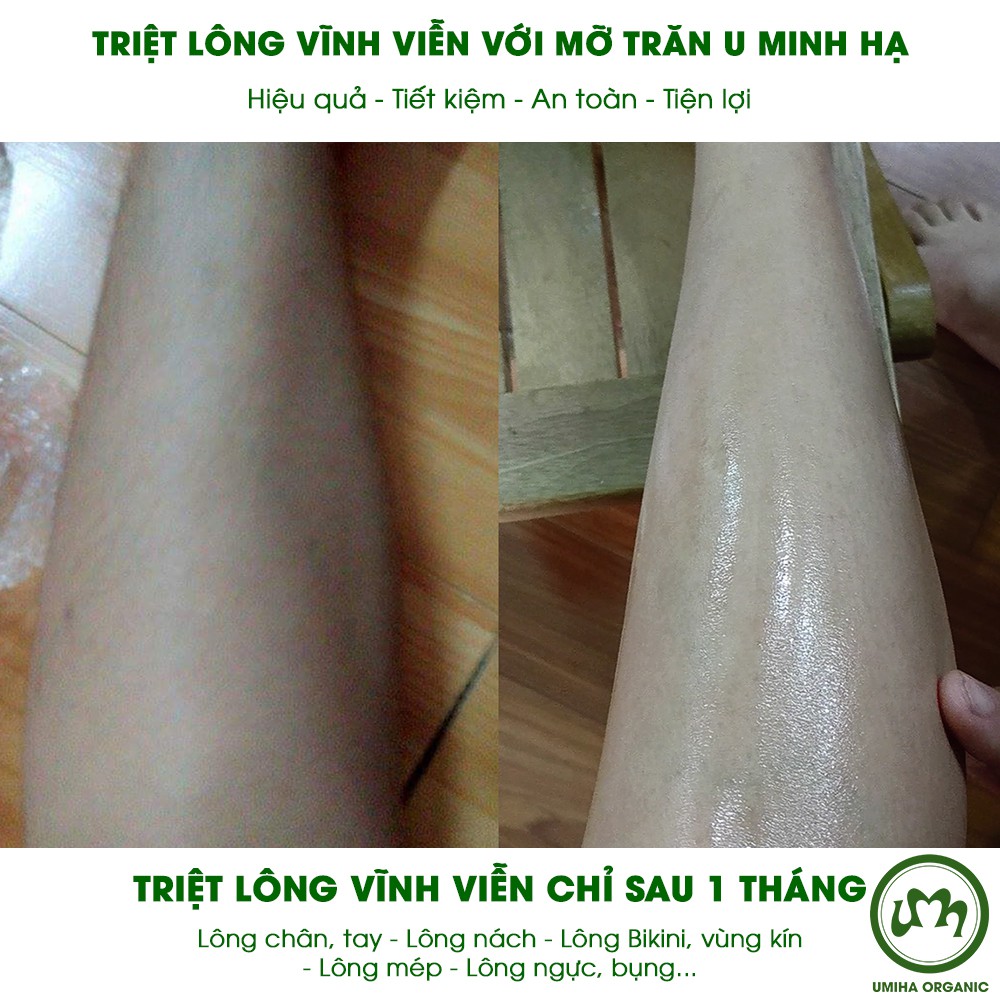 Combo 3 hộp Mỡ trăn triệt lông vĩnh viễn UMIHA (30ml x3) - Tặng 1 hộp Kem tẩy lông Umi 4C (100ml) cho da nhạy cảm