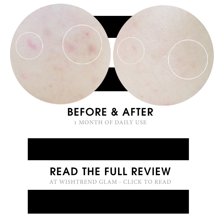 Tẩy Da Chết Hóa Học COSRX BHA Blackhead Power Liquid 100ml | BigBuy360 - bigbuy360.vn