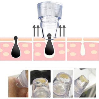 Siêu Máy Hút Mụn_Sạch Mụn Tận Gốc