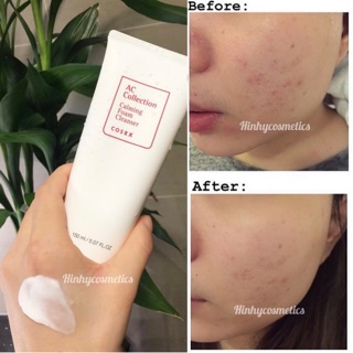 Sữa Rửa Mặt COSRX AC COLLECTION CALMING FOAM CLEANSER