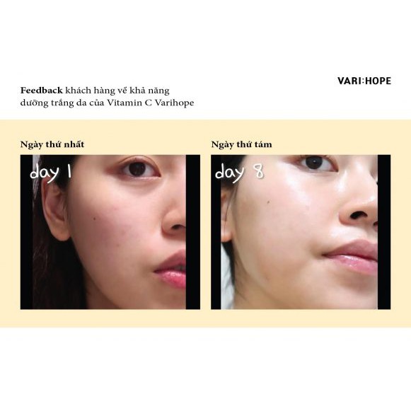 Giảm thâm dưỡng sáng sau 8 ngày Varihope 8 Day Pure Vitamin C Ampoule | BigBuy360 - bigbuy360.vn