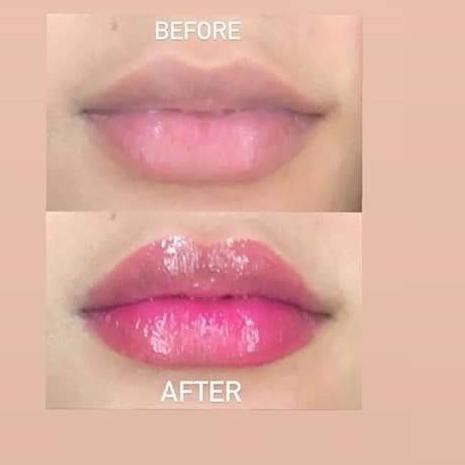 (Hàng Mới Về) Serum Raecca Lippie Dưỡng Da Hiệu Quả | BigBuy360 - bigbuy360.vn