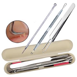 Bộ 3 cây nặn mụn tiện dụng