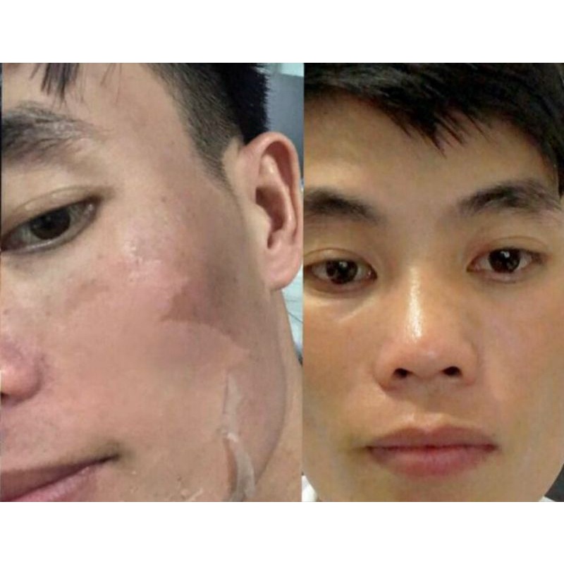 COMBO Lột Da Mặt Sinh Học BEZY Thái lan – mẫu mới 2021