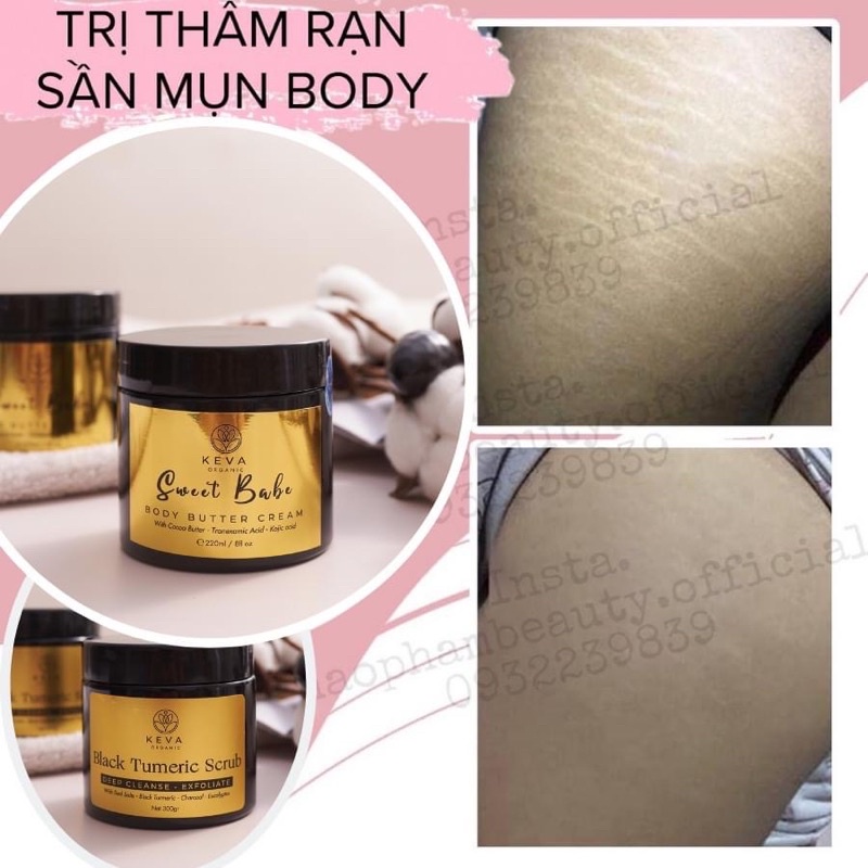 COMBO GIẢM THÂM SẦN RẠN DA BODY CHUYÊN SÂU X1000 KEVA 250gr