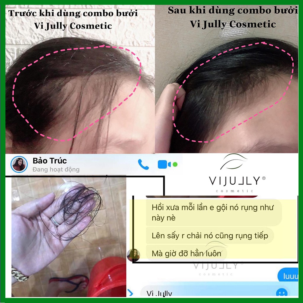 Combo Vijully liệu trình giảm rụng tóc:  Dầu gội Pomelo Shampo + Dầu xả Daisy Conditioner + Xịt Dưỡng Tóc Hair Lotion