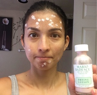 Đủ Bill-chấm mụn Mario Badescu drying lotion