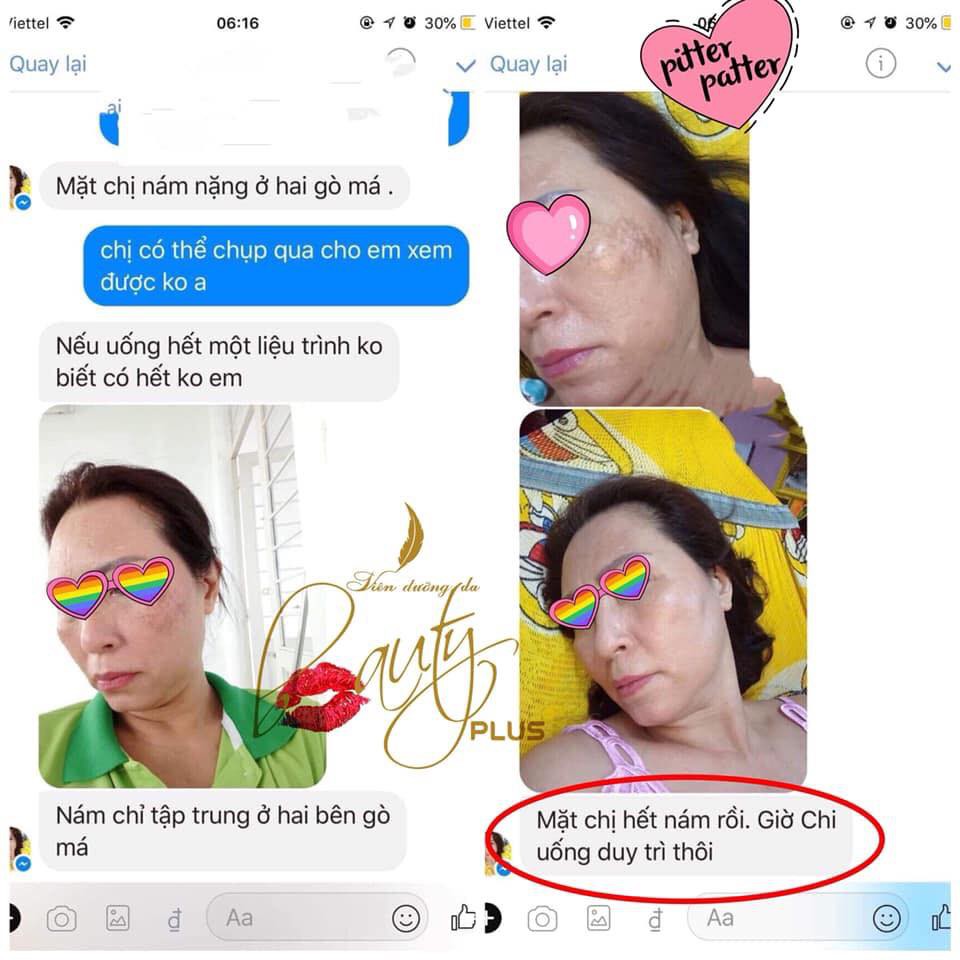 Viên Uống Trắng Da Beauty Plus | BigBuy360 - bigbuy360.vn