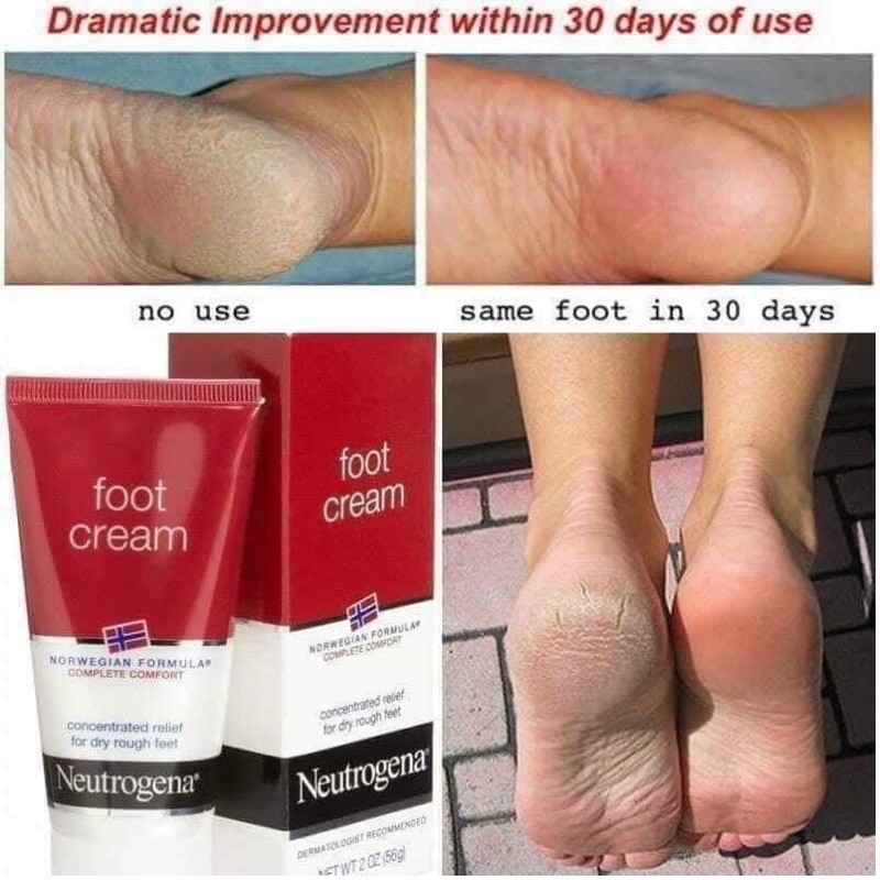 Foot Cream Kem Hết Nứt Mềm Hồng Gót Chân