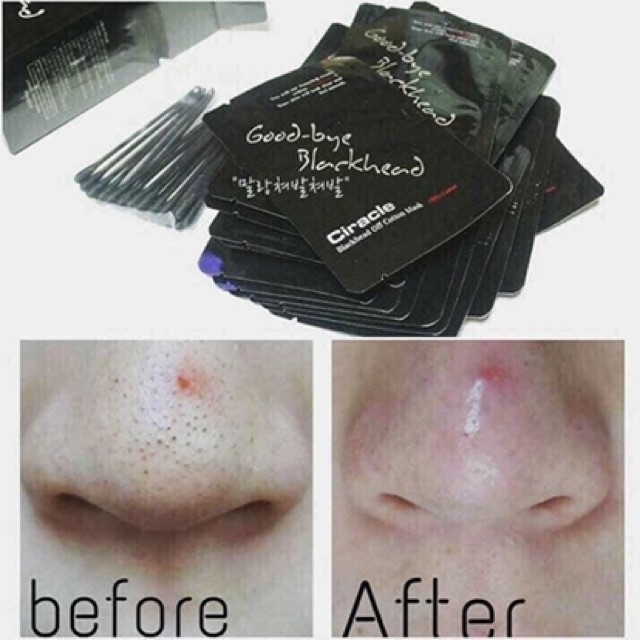 Miếng đẩy mụn đầu đen Blackhead (kèm cây nặn)