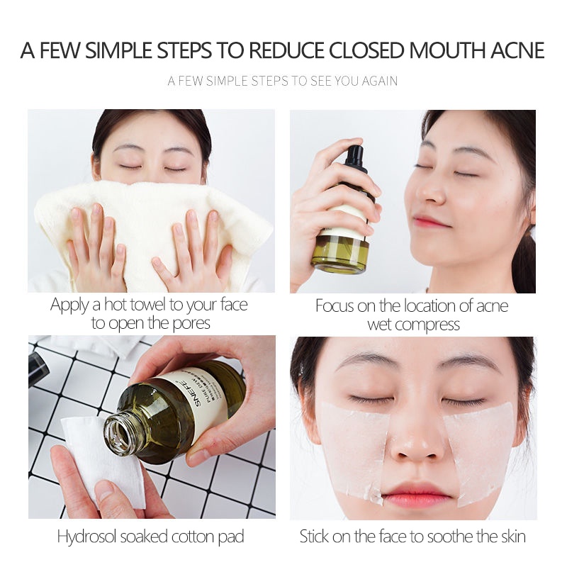 (Hàng Mới Về) Dung Dịch Trị Mụn Đầu Đen Kiềm Dầu Dưỡng Ẩm Thu Nhỏ Lỗ Chân Lông 125ml Snefe | BigBuy360 - bigbuy360.vn