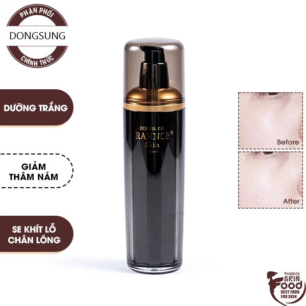 Nước Hoa Hồng Dưỡng Trắng, Hỗ Trợ Giảm Mụn, Nám Dongsung Rannce Skin 130ml